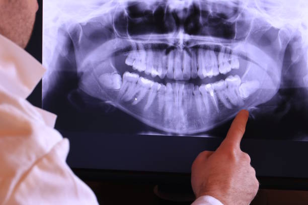 Best Emergency Root Canal Treatment in Lake Winnebago, MO